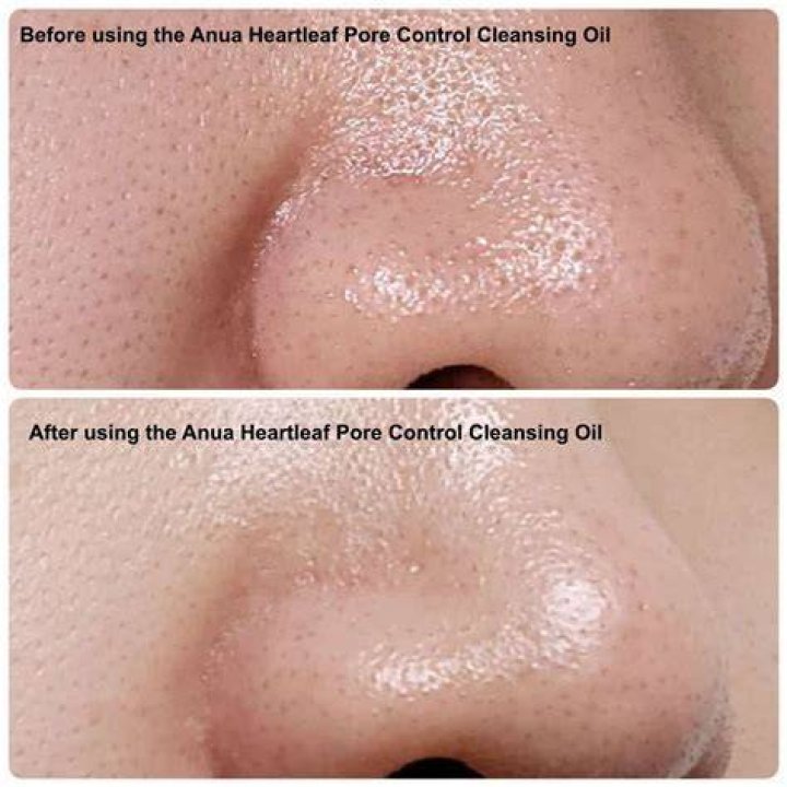 ANUA Heartleaf Pore Control Cleansing Oil 200ml Best Price and Fast