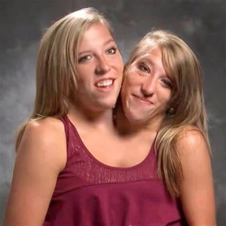 Are conjoined twins Abby and Brittany Hensel married in 2020? Tuko.co.ke