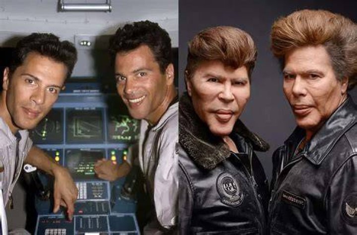 bogdanoff brothers plastic surgery