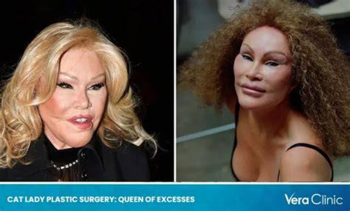 Cat Lady Plastic Surgery Catladyplasticsurgery Catlady houshow Cat