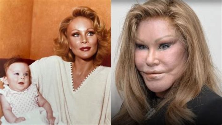 Catwoman Plastic Surgery Before And After