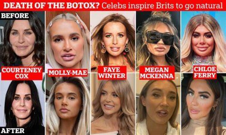Celebrities Who Use Dermal Fillers Injectables Dubai