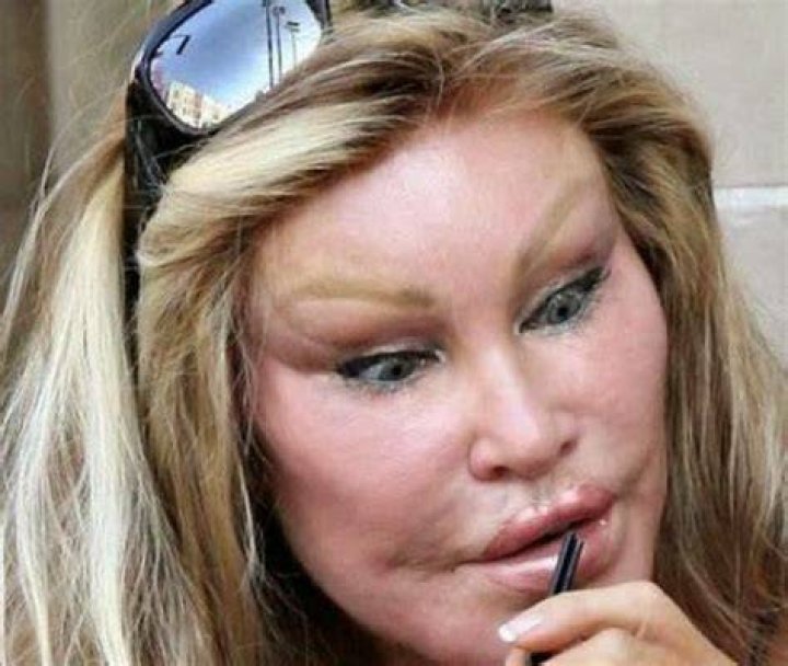 CHIRURGIE ESTHETIQUE BIEN CHERE, REND PLUS BELLE. ou plus moche!!!