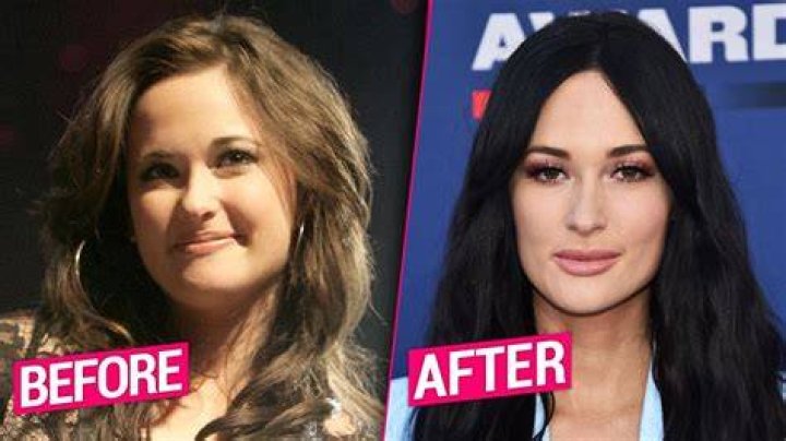 Kacey Musgraves Transformation, Plastic Surgery Speculation Life & Style