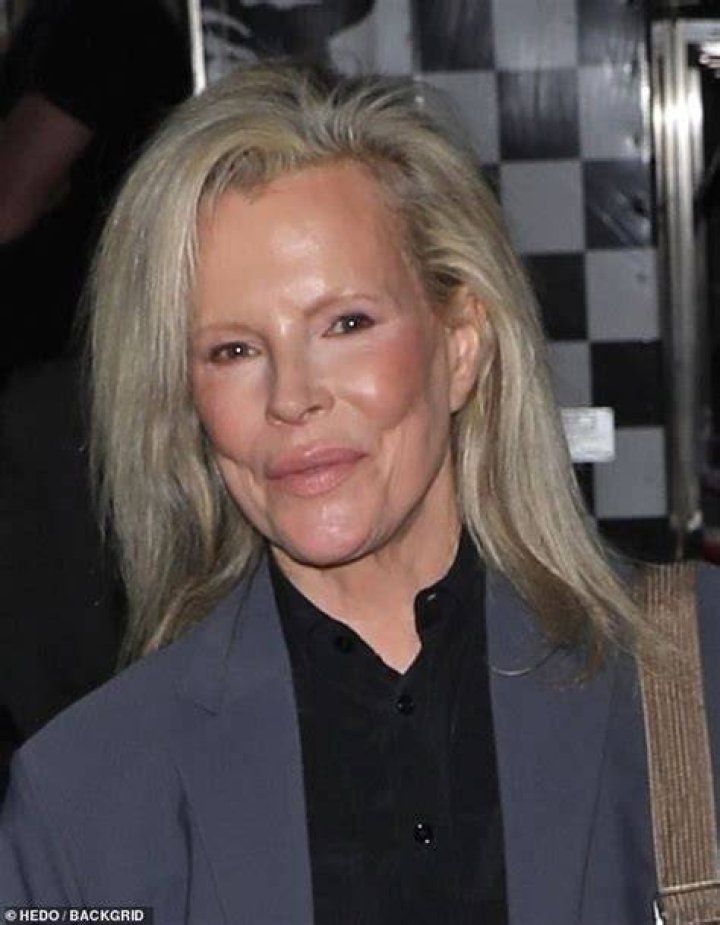 Kim Basinger Dishes on Her Painful Divorce From Alec Baldwin Closer