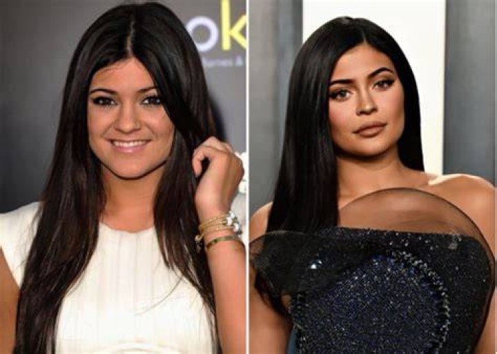 kylie jenner before and after Recherche Google Peinados f&aacute;ciles para cabello corto, Labios