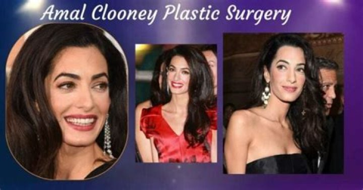 Plastic Is Perfect! Amal Clooney's Shocking New Face Is From Secret