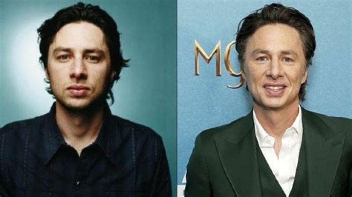 Unveiling The Truth: "Zach Braff Plastic Surgery"