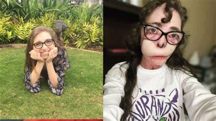 Where Is Jacqueline Durand From Dog Attack Incident?