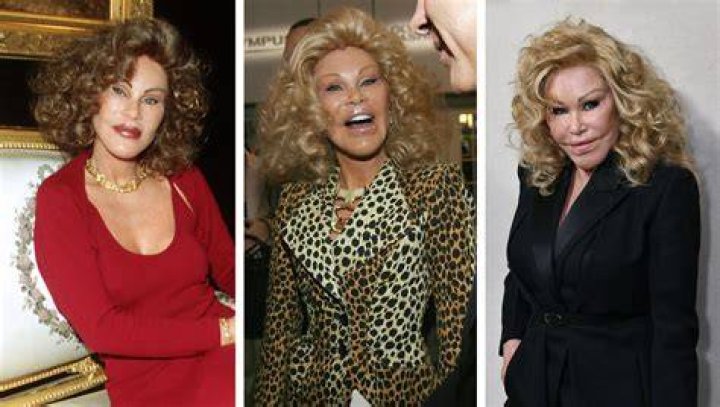 Who is Jocelyn Wildenstein, what did she look like when she was young